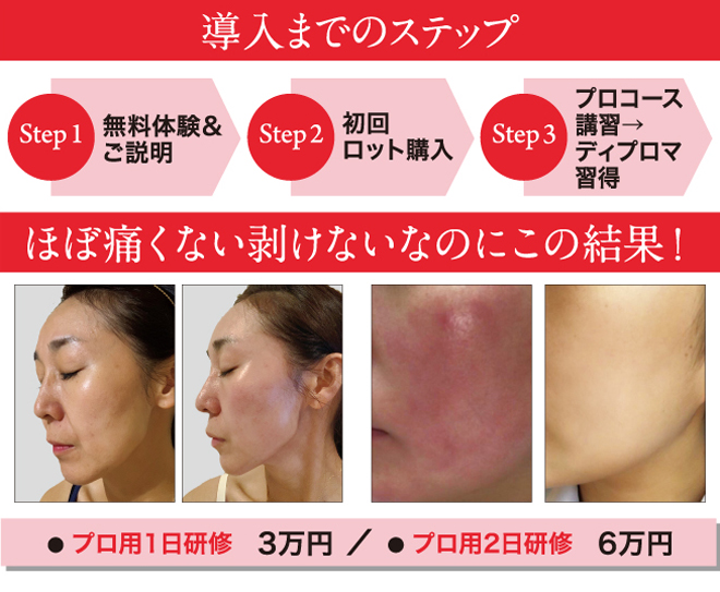 導入までのステップ